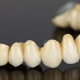 Zahn aus Porzellan
