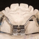 Apparecchi Ortodontici