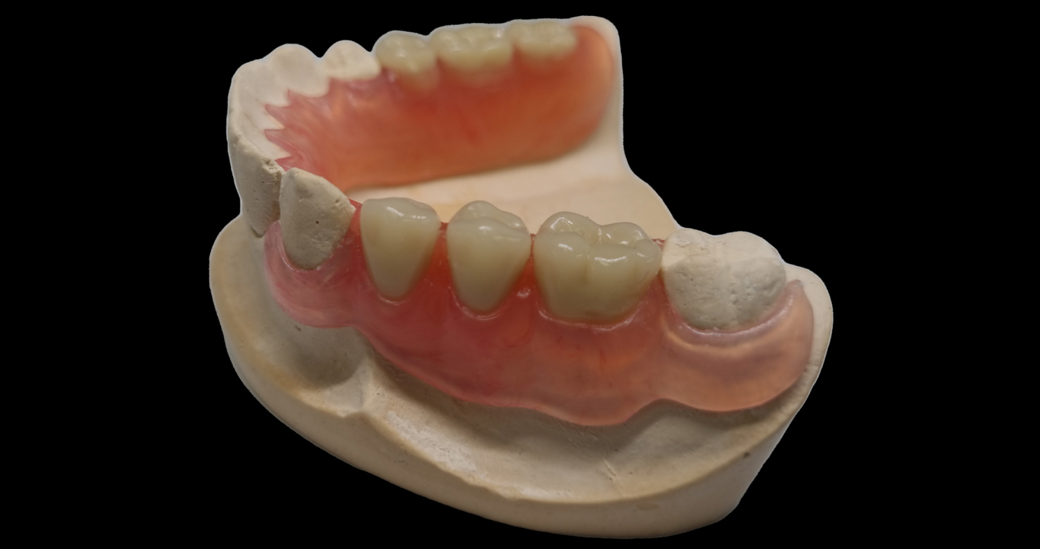 Valplast Alize Dentaire